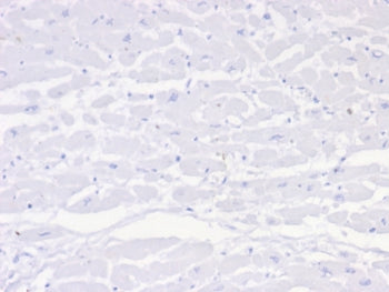 Negative Control Antibody for Mouse Monoclonals