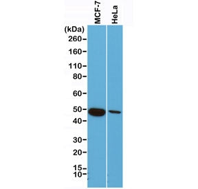 Western blot of human MCF7 and HeLa cell lysate using recombinant Cytokeratin 18 antibody at 1:1000.