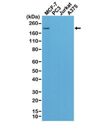 Western blot of MCF7, PC3, Jurkat, and A375 cell lysate using recombinant HER2 antibody. Only the br