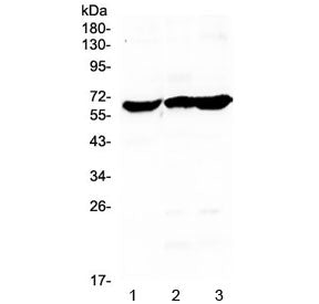 Western blot testing of human 1) SW579, 2) SKOV3 and 3) U-87 MG cell lysate with Glycerol kinase ant