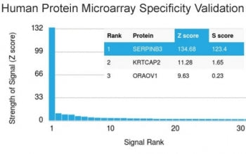 Analysis of HuProt(TM) microarray containing more than 19,000 full-length human proteins using SERPI