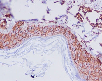 IHC staining of FFPE human skin with CD44 antibody. HIER: boil tissue sections in pH6, 10mM citrate 
