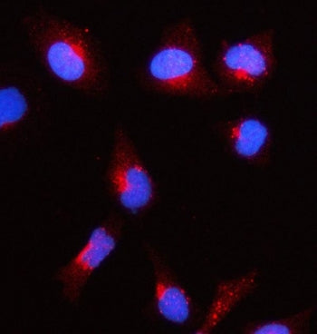 ACAT1 Antibody