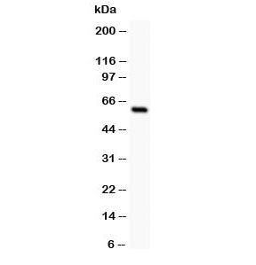 Western blot testing of SSTR1 antibody and rat intestine lysate; The protein is routinely visualized