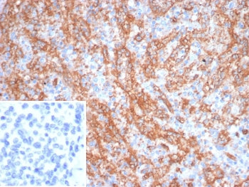 IHC staining of FFPE human spleen tissue with Platelet glycoprotein 4 antibody (clone CD36/7216). In