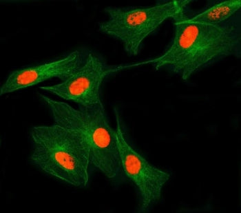 SNRNP27 Antibody