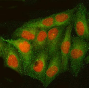 ATF4 Antibody