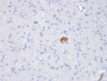 IHC staining of FFPE human brain with Beta Amyloid antibody (clone APP/3343). HIER: boil tissue sect