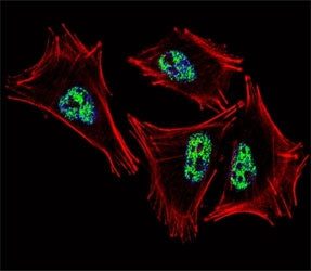 Fluorescent confocal image of A2058 cell stained with PROX1 antibody at 1:25. PROX1 immunoreactivity
