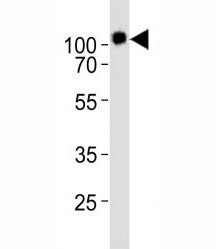 Western blot analysis of lysate from KG-1 cell line using CD34 antibody diluted at 1:1000. Expected 