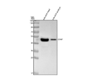 Western blot analysis of Gfap protein using Zebrafish Gfap antibody and 1) zebrafish head tissue lys