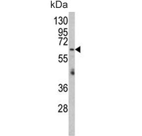 Western blot testing of human HepG2 cell lysate with RARS2 antibody. Predicted molecular weight ~66 