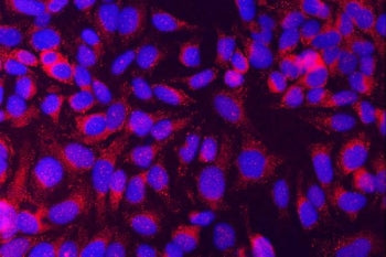 MUNC18-1 Antibody / STXBP1