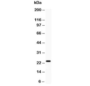 Claudin 5 Antibody