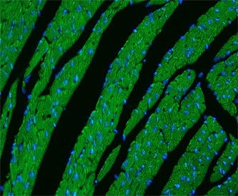 CPT1B Antibody