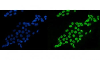 SF1 Antibody / Splicing factor 1