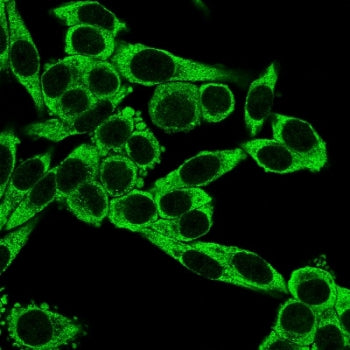 CCR5 Antibody