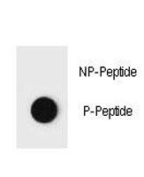 Dot blot analysis of phospho-PTEN antibody. 50ng of phos-peptide or nonphos-peptide per dot were spo