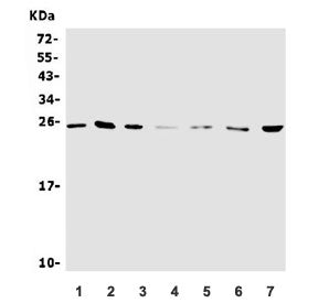 Western blot testing of 1) human HEK293, 2) human SW620, 3) human HeLa, 4) rat RH35, 5) mouse spleen