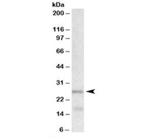 Western blot testing of human cerebellum lysate with TPPP antibody at 0.001ug/ml. Predicted molecula