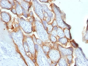 HCG-beta Antibody