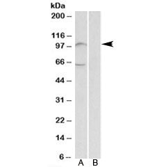 UNC5B Antibody