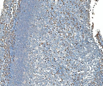 IHC staining of FFPE human tonsil tissue with TDRD11 antibody. HIER: boil tissue sections in pH8 EDT