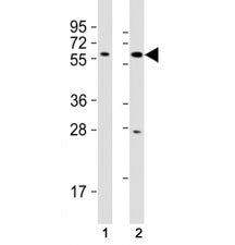 Western blot testing of SOX10 antibody at 1:2000 dilution. Lane 1: C6 lysate; 2: A375 lysate; Predic