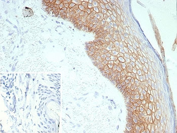Desmoglein 3 Antibody / DSG3
