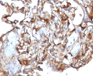 CD146 Antibody / MCAM / MUC18