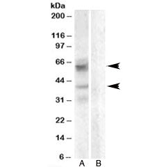Arylsulfatase D Antibody