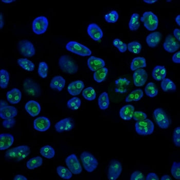 Nucleolin Antibody