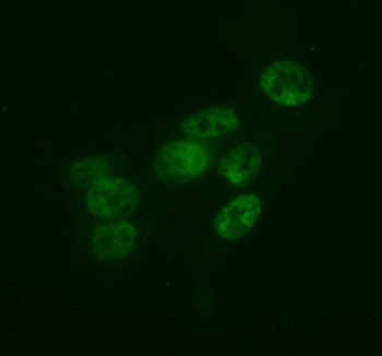 Immunofluorescent staining of FFPE human HepG2 cells with HLF antibody (green). HIER: steam section 