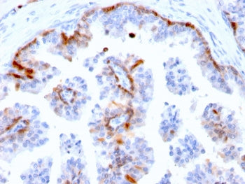 IHC staining of FFPE human prostate with Cystatin A antibody (clone CSTA/2882). HIER: boil tissue se
