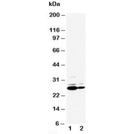 C Reactive Protein Antibody