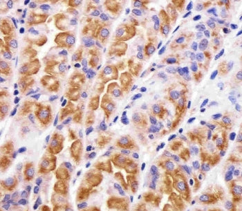 IHC testing of FFPE human stomach tissue with VAMP-8 antibody. HIER: steam section in pH6 citrate bu