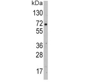Western blot analysis of GLUT2 antibody and HepG2 lysate. Expected molecular weight: 57~70 kDa depen