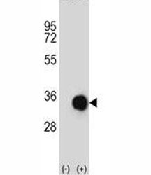 Caspase-6 Antibody, 0.4ml