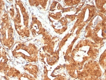 IHC staining of FFPE human prostate tissue with MIF antibody (clone MIF/6281). HIER: boil tissue sec