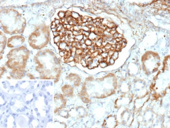 IHC staining of FFPE human kidney tissue with PLA2R1 antibody (clone PLA2R1/4893). Inset: PBS used i