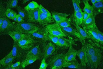ALDH1A1 Antibody / Acetaldehyde dehydrogenase 1