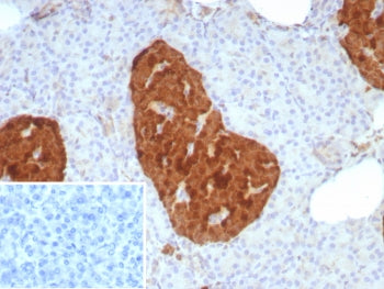 IHC staining of FFPE human pancreas tissue with ENO2 antibody (clone rENO/8857). Inset: PBS used in 