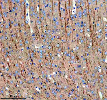 Immunohistochemical staining of MAP1B using anti-MAP1B antibody. MAP1B was detected in a paraffin-em