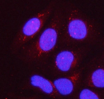 PPP1R15B Antibody / Protein phosphatase 1 regulatory subunit 15B