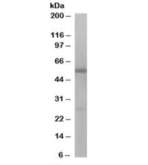 Western blot testing of Jurkat lysate with DBNL antibody at 1ug/ml. Predicted molecular weight: ~49k