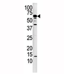 Calcineurin Antibody (PPP3CA)