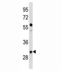 Cyclin D2 Antibody (CCND2)