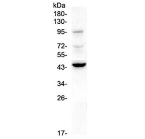 Western blot testing of human A375 cell lysate with CD72 antibody at 0.5ug/ml. Expected molecular we