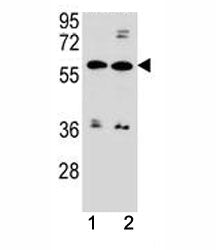 ABCG4 antibody western blot analysis in MDA-MB453, ZR-75-1 lysate. Predicted molecular weight 60-80 