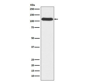 Western blot testing of human A549 cell lysate with OGT antibody. Predicted molecular weight: 110-11